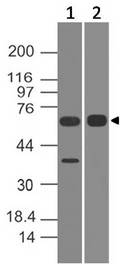 ALAS1 Antibody - Fig-1: Western blot analysis of ALAS1. Anti-ALAS1 antibody was used at 2 µg/ml on (1) h Liver and (2) h Stomach lysates.