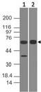 ALAS1 Antibody - Fig-1: Western blot analysis of ALAS1. Anti-ALAS1 antibody was used at 2 µg/ml on (1) h Liver and (2) h Stomach lysates.