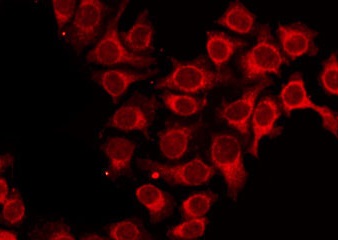 ALAS1 Antibody - Staining HepG2 cells by IF/ICC. The samples were fixed with PFA and permeabilized in 0.1% Triton X-100, then blocked in 10% serum for 45 min at 25°C. The primary antibody was diluted at 1:200 and incubated with the sample for 1 hour at 37°C. An Alexa Fluor 594 conjugated goat anti-rabbit IgG (H+L) Ab, diluted at 1/600, was used as the secondary antibody.