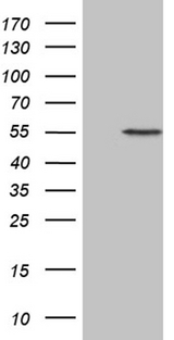ALAS2 Antibody - HEK293T cells were transfected with the pCMV6-ENTRY control. (Left lane) or pCMV6-ENTRY ALAS2. (Right lane) cDNA for 48 hrs and lysed