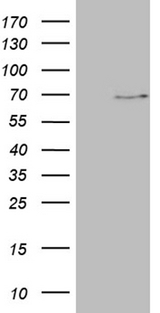 ALAS2 Antibody - HEK293T cells were transfected with the pCMV6-ENTRY control. (Left lane) or pCMV6-ENTRY ALAS2. (Right lane) cDNA for 48 hrs and lysed. Equivalent amounts of cell lysates. (5 ug per lane) were separated by SDS-PAGE and immunoblotted with anti-ALAS2. (1:2000)