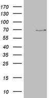 ALAS2 Antibody - HEK293T cells were transfected with the pCMV6-ENTRY control. (Left lane) or pCMV6-ENTRY ALAS2. (Right lane) cDNA for 48 hrs and lysed. Equivalent amounts of cell lysates. (5 ug per lane) were separated by SDS-PAGE and immunoblotted with anti-ALAS2. (1:2000)