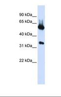 ALAS2 Antibody - Transfected 293T cell lysate. Antibody concentration: 1.0 ug/ml. Gel concentration: 12%.  This image was taken for the unconjugated form of this product. Other forms have not been tested.