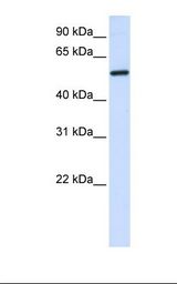 ALAS2 Antibody - Transfected 293T cell lysate. Antibody concentration: 1.0 ug/ml. Gel concentration: 12%.  This image was taken for the unconjugated form of this product. Other forms have not been tested.