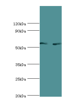 ALAS2 Antibody - Western blot. All lanes: 5-aminolevulinate synthase, erythroid-specific, mitochondrial antibody at 7 ug/ml. Lane 1: 293T whole cell lysate. Lane 2: mouse brain tissue. Secondary antibody: Goat polyclonal to rabbit at 1:10000 dilution. Predicted band size: 65 kDa. Observed band size: 65 kDa.