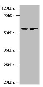 ALAS2 Antibody - Western blot All lanes: 5-aminolevulinate synthase, erythroid-specific, mitochondrial antibody at 7µg/ml Lane 1: 293T whole cell lysate Lane 2: Mouse brain tissue Secondary Goat polyclonal to rabbit IgG at 1/10000 dilution Predicted band size: 65, 61, 50, 64 kDa Observed band size: 65 kDa