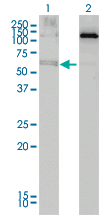 ALAS2 Antibody - Western Blot analysis of ALAS2 expression in transfected 293T cell line by ALAS2 monoclonal antibody (M01), clone 6C1.Lane 1: ALAS2 transfected lysate(64 KDa).Lane 2: Non-transfected lysate.
