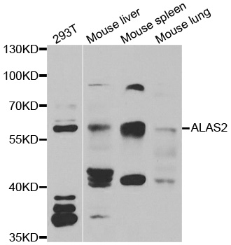 ALAS2 Antibody - Western blot analysis of extracts of various cell lines.