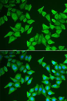 ALAS2 Antibody - Immunofluorescence analysis of HeLa cells.