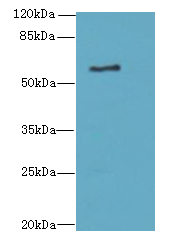 ALAS2 Antibody - Western blot. All lanes: ALAS2 antibody at 6 ug/ml+K54- whole cell lysate Goat polyclonal to rabbit at 1:10000 dilution. Predicted band size: 65 kDa. Observed band size: 65 kDa.