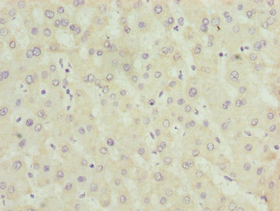 ALAS2 Antibody - Immunohistochemistry of paraffin-embedded human liver tissue using ALAS2 Antibody at dilution of 1:100
