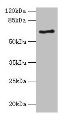 ALAS2 Antibody - Western blot All lanes: ALAS2 antibody at 6µg/ml + K562 whole cell lysate Secondary Goat polyclonal to rabbit IgG at 1/10000 dilution Predicted band size: 65, 61, 50, 64 kDa Observed band size: 65 kDa
