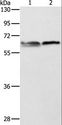 ALAS2 Antibody - Western blot analysis of 293T and Jurkat cell, using ALAS2 Polyclonal Antibody at dilution of 1:1000.