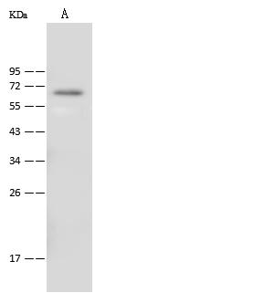 ALAS2 Antibody - Anti-ALAS2 rabbit polyclonal antibody at 1:500 dilution. Lane A: 293 Whole Cell Lysate. Lysates/proteins at 30 ug per lane. Secondary: Goat Anti-Rabbit IgG (H+L)/HRP at 1/10000 dilution. Developed using the ECL technique. Performed under reducing conditions. Predicted band size: 65 kDa. Observed band size: 65 kDa.