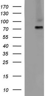 ALB / Serum Albumin Antibody - HEK293T cells were transfected with the pCMV6-ENTRY control (Left lane) or pCMV6-ENTRY ALB (Right lane) cDNA for 48 hrs and lysed. Equivalent amounts of cell lysates (5 ug per lane) were separated by SDS-PAGE and immunoblotted with anti-ALB.