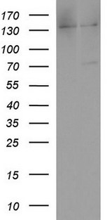 ALB / Serum Albumin Antibody - HEK293T cells were transfected with the pCMV6-ENTRY control (Left lane) or pCMV6-ENTRY ALB (Right lane) cDNA for 48 hrs and lysed. Equivalent amounts of cell lysates (5 ug per lane) were separated by SDS-PAGE and immunoblotted with anti-ALB.