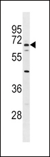 ALB / Serum Albumin Antibody - ALB Antibody western blot of 293 cell line lysates (35 ug/lane). The ALB antibody detected the ALB protein (arrow).
