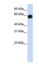 ALB / Serum Albumin Antibody - ALB / Albumin antibody Western blot of Fetal Brain lysate. This image was taken for the unconjugated form of this product. Other forms have not been tested.