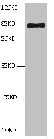 ALB / Serum Albumin Antibody - All lanes: Mouse Anti-BSA monoclonal antibody at 1ug/ml Lane 1:Bovine serum Albumin Predicted band size : 67kd Observed band size : 67kd