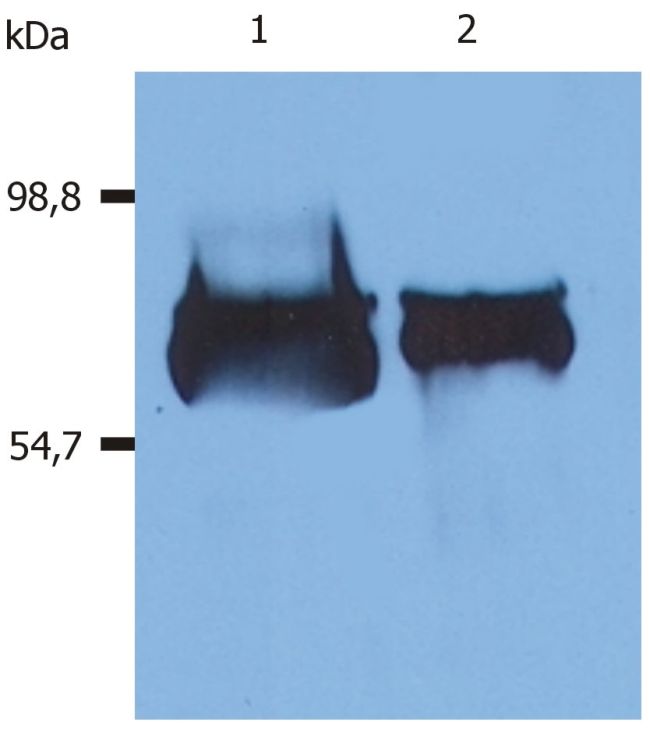 ALB / Serum Albumin Antibody - Human Serum Albumin Antibody in Western Blot (WB)