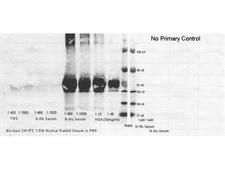 ALB / Serum Albumin Antibody - Secondary Antibodies - Western Blot. secondary antibodies detect rabbit primary antibodies in a variety of platforms. Shown here is a serial 1:1 dilution of control rabbit IgG protein ( 250 ng starting total load) co incubated with LS-C60865 and 1:20K in MB-070. Blot was dried and imaged (A) on Bio-Rad Versa Doc (30 sec, DyLight649), (B) LiCor Odyssey Reader (700 nm), (C ) Rewetted incubated with Femtomax 110 reimaged using BioVersaDoc (for 60 sec), (D) Incubated with TMB substrate TMBM for 5 minutes and scanned, and (E) Rewetted for Chemiluminescence and imaged for 90 sec on the BioRad VersaDoc Imager,. This image was taken for the unconjugated form of this product. Other forms have not been tested.
