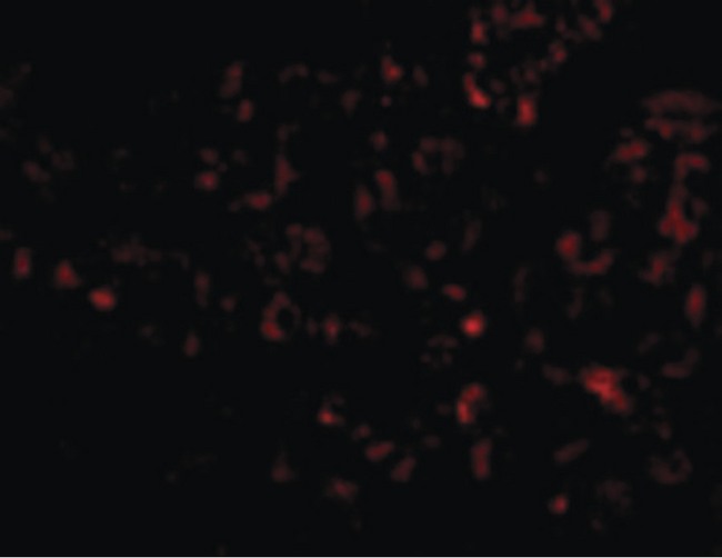 ALB / Serum Albumin Antibody - Immunofluorescence of Albumin in Human Liver cells with Albumin antibody at 20 ug/ml.