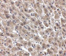 ALB / Serum Albumin Antibody - Immunohistochemistry of Albumin in human liver tissue with Albumin antibody at 2.5 ug/ml.