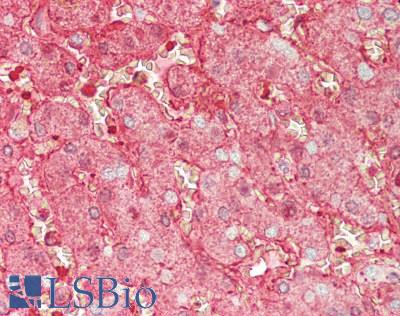 ALB / Serum Albumin Antibody - Human Liver: Formalin-Fixed, Paraffin-Embedded (FFPE)