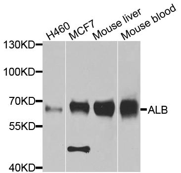 ALB / Serum Albumin Antibody - Western blot analysis of extracts of various cell lines, using ALB antibody at 1:1000 dilution. The secondary antibody used was an HRP Goat Anti-Rabbit IgG (H+L) at 1:10000 dilution. Lysates were loaded 25ug per lane and 3% nonfat dry milk in TBST was used for blocking. An ECL Kit was used for detection and the exposure time was 15s.