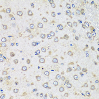 ALB / Serum Albumin Antibody - Immunohistochemistry of paraffin-embedded rat brain using ALB antibodyat dilution of 1:100 (40x lens).