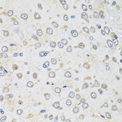 ALB / Serum Albumin Antibody - Immunohistochemistry of paraffin-embedded rat brain using ALB antibodyat dilution of 1:100 (40x lens).