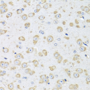 ALB / Serum Albumin Antibody - Immunohistochemistry of paraffin-embedded mouse brain using ALB antibodyat dilution of 1:100 (40x lens).