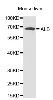 ALB / Serum Albumin Antibody - Western blot analysis of extracts of mouse liver.