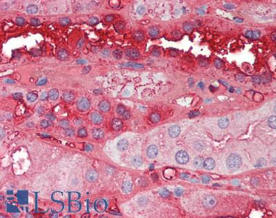 ALB / Serum Albumin Antibody - Human Kidney: Formalin-Fixed, Paraffin-Embedded (FFPE)