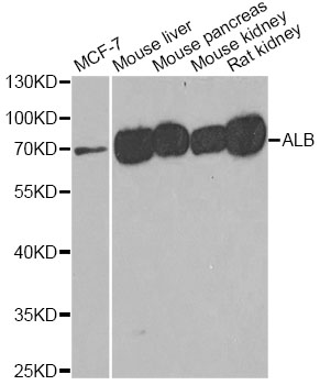 ALB / Serum Albumin Antibody - Western blot analysis of extracts of various cell lines, using ALB antibody at 1:500 dilution. The secondary antibody used was an HRP Goat Anti-Rabbit IgG (H+L) at 1:10000 dilution. Lysates were loaded 25ug per lane and 3% nonfat dry milk in TBST was used for blocking. An ECL Kit was used for detection and the exposure time was 90s.