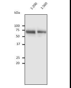 ALB / Serum Albumin Antibody - Anti-Albumin antibody at 1:2500 dilution. 10 ul of diluted human serum per lane. Rabbit polyclonal to goat IgG (HRP) at 1:10000 dilution;