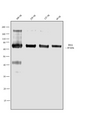 ALB / Serum Albumin Antibody - Western blot analysis was performed by loading 500 ng (Lane 1), 250 ng (Lane 2), 125 ng (Lane 3) and 60 ng (Lane 4) of BSA. The blot was probed with Anti- Bovine Serum Albumin Rabbit Polyclonal Antibody and detected by chemiluminescence using Goat anti-Rabbit IgG (H+L) Superclonal Secondary Antibody, HRP conjugate. A 69 kDa band corresponding to Bovine Serum Albumin was observed. Known quantity of protein samples were electrophoresed using 12 % Bis-Tris gel. Resolved proteins were then transferred onto a nitrocellulose membrane. The membrane was probed with the relevant primary and secondary Antibody following blocking with 5 % skimmed milk.