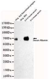 ALB / Serum Albumin Antibody - Western blot detection of Human Serum Albumin in 0.5nl human serum and 10ng ALB Recombinant antigens cell lysates using Human Serum Albumin mouse monoclonal antibody (1:2000 dilution). Predicted band size: 67KDa. Observed band size:67KDa.