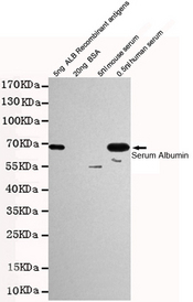 ALB / Serum Albumin Antibody - Western blot detection of Human Serum Albumin in 0.5nl human serum and 5ng ALB Recombinant antigens cell lysates using Human Serum Albumin mouse monoclonal antibody (1:1000 dilution). Predicted band size: 67KDa. Observed band size:67KDa.