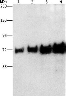 ALB / Serum Albumin Antibody - Western blot analysis of 0.05-0.4ug BSA, using BSA Polyclonal Antibody at dilution of 1:1150.
