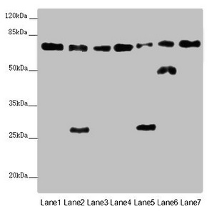 ALB / Serum Albumin Antibody - Western blot All Lanes :ALB antibody at 2 ug/ml Lane 1 : Mouse heart tissue Lane 2 : Mouse liver tissue Lane 3 : Mouse spleen tissue Lane 4 : Mouse lung tissue Lane 5 : Mouse kidney tissue Lane 6 : Mouse brain tissue Lane 7 : Mouse skeletal muscle tissue Secondary Goat polyclonal to rabbit IgG at 1/10000 dilution Predicted band size: 70,48,46 kDa Observed band size: 69,50,27 kDa