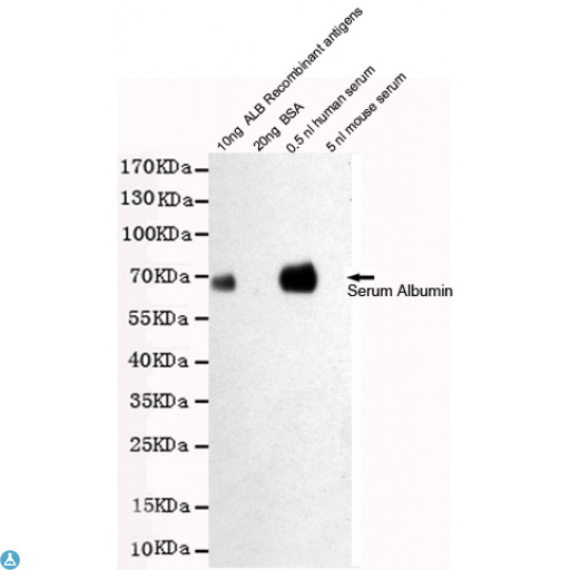 ALB / Serum Albumin Antibody - Western blot detection of Human Serum Albumin in 0. 5nl human serum and 10ng ALB Recombinant antigens cell lysates using Human Serum Albumin mouse mAb (1:2000 diluted). Predicted band size: 67KDa. Observed band size: 67KDa.