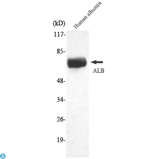 ALB / Serum Albumin Antibody - Western Blot (WB) analysis using ALB Monoclonal Antibody against human albumin whole cell lysate.