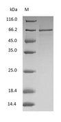 ALB / Serum Albumin Protein - (Tris-Glycine gel) Discontinuous SDS-PAGE (reduced) with 5% enrichment gel and 15% separation gel.