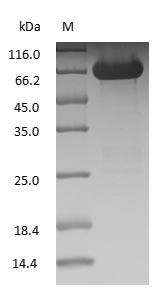 ALB / Serum Albumin Protein - (Tris-Glycine gel) Discontinuous SDS-PAGE (reduced) with 5% enrichment gel and 15% separation gel.