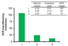 Albumin Creatinine Ratio Lsbio