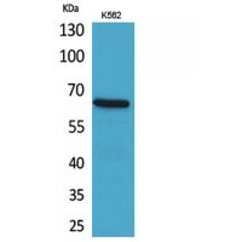 ALCAM / CD166 Antibody - Western blot of CD166 antibody