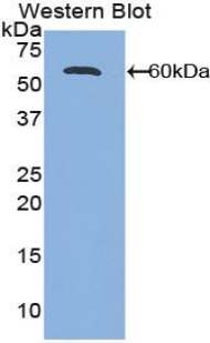 ALCAM / CD166 Antibody - Western blot of recombinant ALCAM / CD166.  This image was taken for the unconjugated form of this product. Other forms have not been tested.