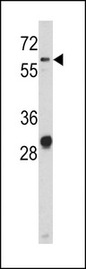 ALCAM / CD166 Antibody - Western blot of CD166 antibody in NCI-H460 cell line lysates (35 ug/lane). CD166 (arrow) was detected using the purified antibody.
