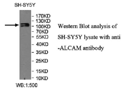 ALCAM / CD166 Antibody - Western blot of ALCAM / CD166 antibody